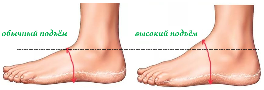Высокий подъём стопы и обычный подъём: сравнение на рисунке